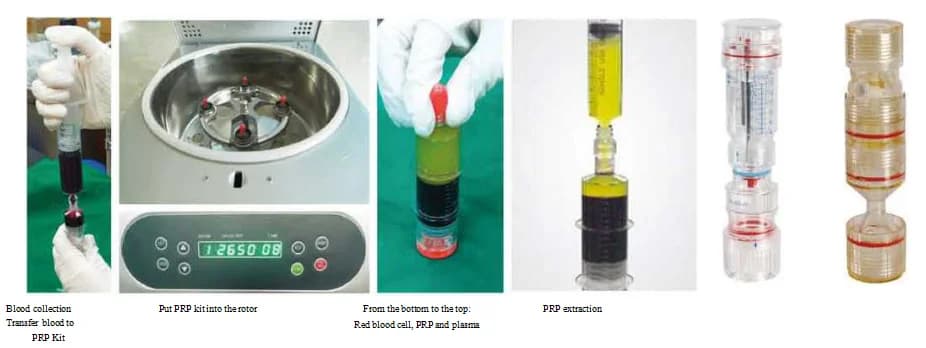 prp centrifuge (1).png